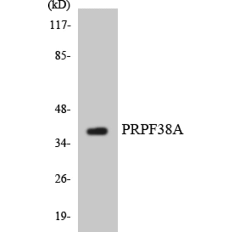 Western Blot - Anti-PRPF38A Antibody (R12-3372) - Antibodies.com