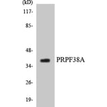 Western Blot - Anti-PRPF38A Antibody (R12-3372) - Antibodies.com