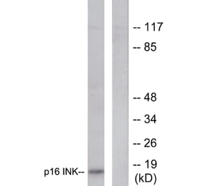 Western Blot - Anti-p16 INK Antibody (C0285) - Antibodies.com