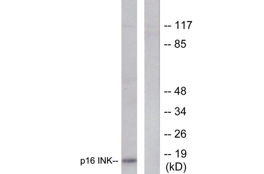 Western Blot - Anti-p16 INK Antibody (C0285) - Antibodies.com