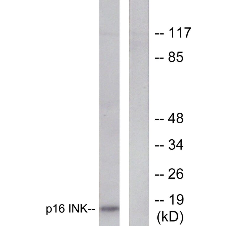 Western Blot - Anti-p16 INK Antibody (C0285) - Antibodies.com
