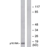 Western Blot - Anti-p16 INK Antibody (C0285) - Antibodies.com