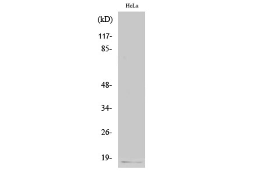 Western Blot - Anti-p16 INK Antibody (C0285) - Antibodies.com