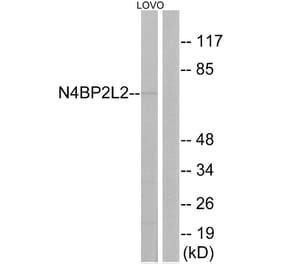 Western Blot - Anti-N4BP2L2 Antibody (C17725) - Antibodies.com