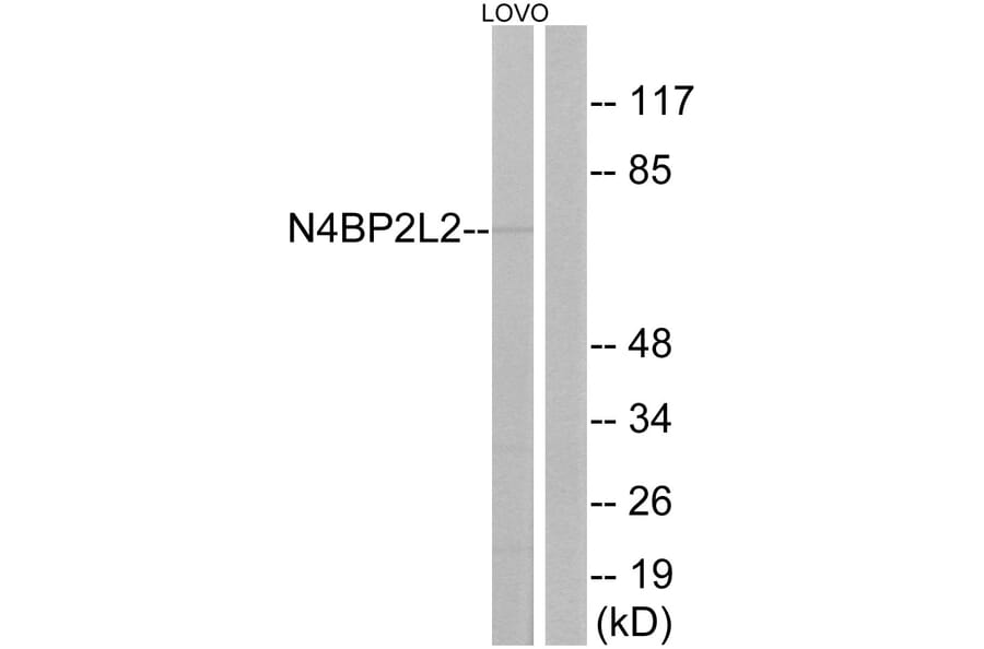 Western Blot - Anti-N4BP2L2 Antibody (C17725) - Antibodies.com
