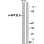 Western Blot - Anti-N4BP2L2 Antibody (C17725) - Antibodies.com