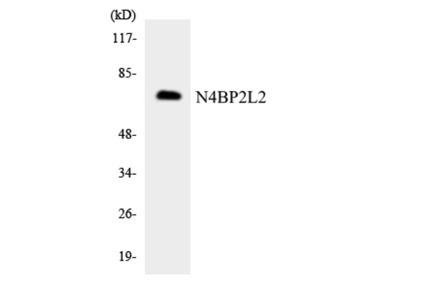 Western Blot - Anti-N4BP2L2 Antibody (R12-3070) - Antibodies.com