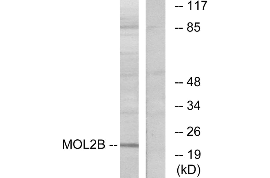 Western Blot - Anti-MOBKL2B Antibody (C11272) - Antibodies.com