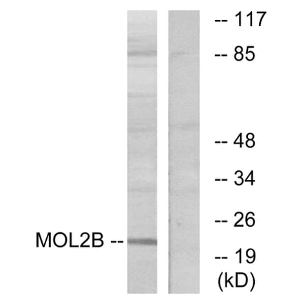 Western Blot - Anti-MOBKL2B Antibody (C11272) - Antibodies.com
