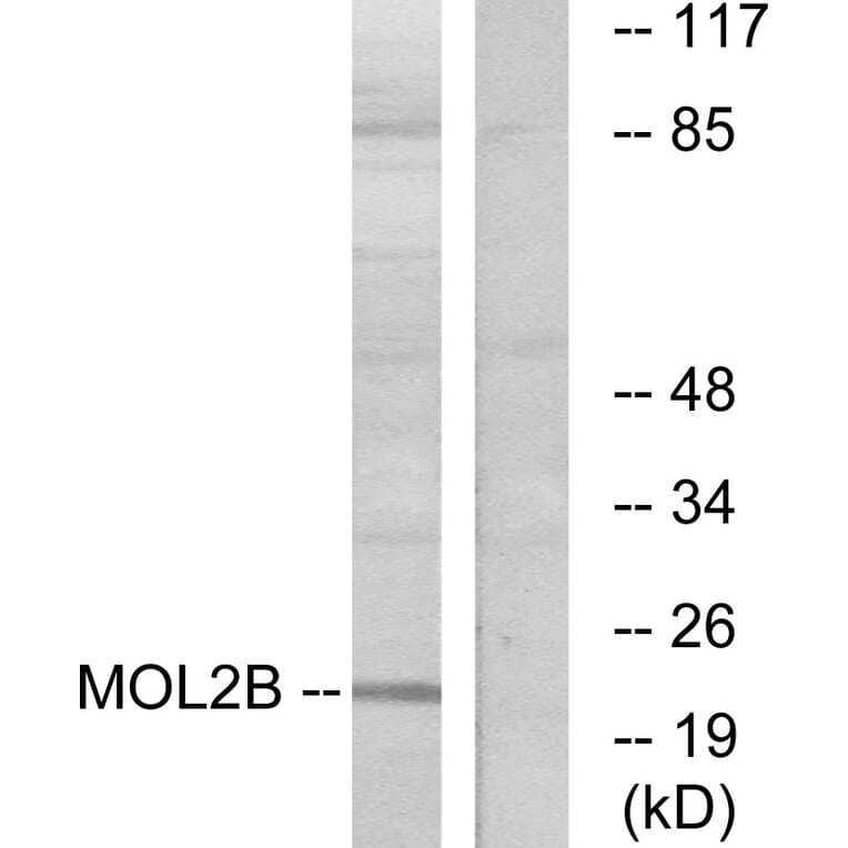 Western Blot - Anti-MOBKL2B Antibody (C11272) - Antibodies.com