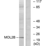Western Blot - Anti-MOBKL2B Antibody (C11272) - Antibodies.com