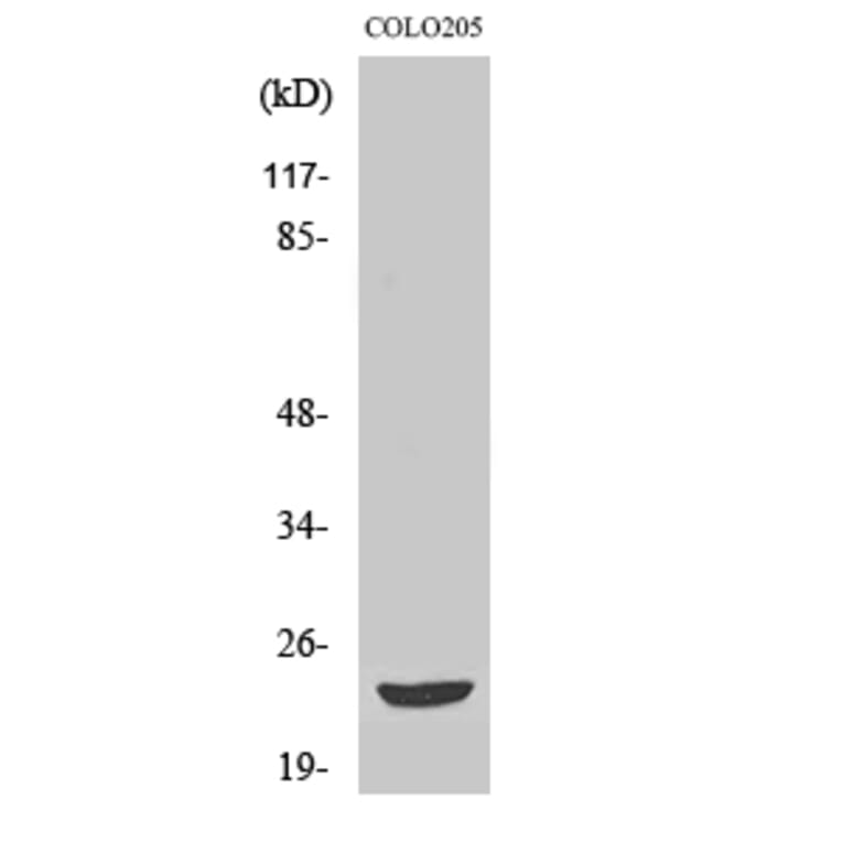 Western Blot - Anti-MOBKL2B Antibody (C11272) - Antibodies.com