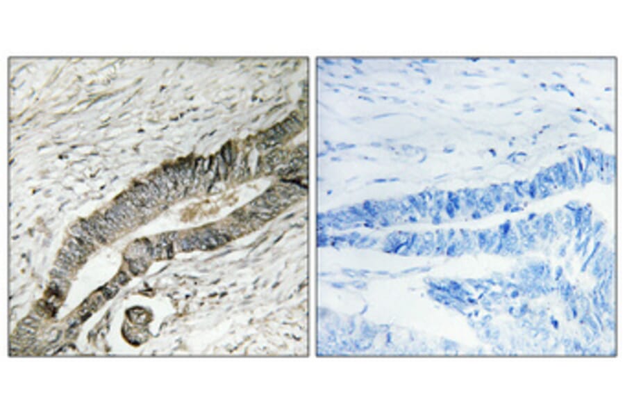 Immunohistochemistry - Anti-MOBKL2B Antibody (C11272) - Antibodies.com