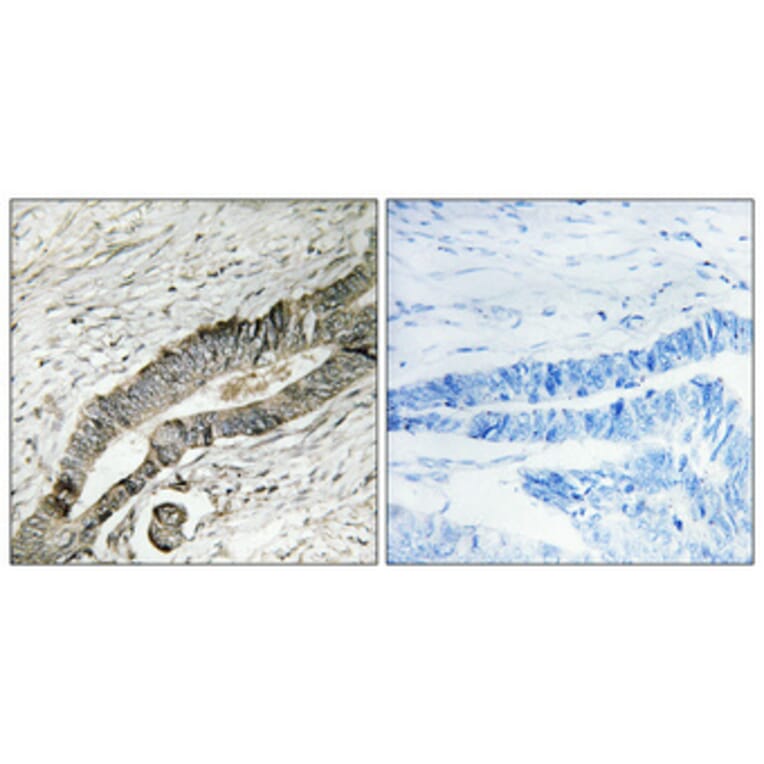 Immunohistochemistry - Anti-MOBKL2B Antibody (C11272) - Antibodies.com