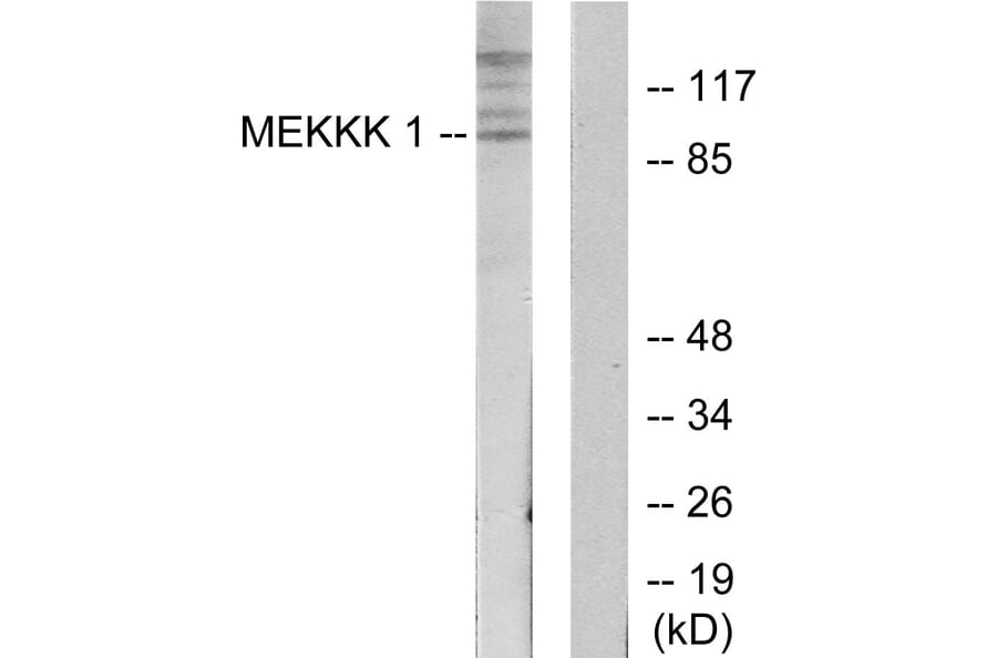 Western Blot - Anti-MEKKK 1 Antibody (C11444) - Antibodies.com