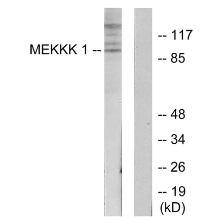 Western Blot - Anti-MEKKK 1 Antibody (C11444) - Antibodies.com