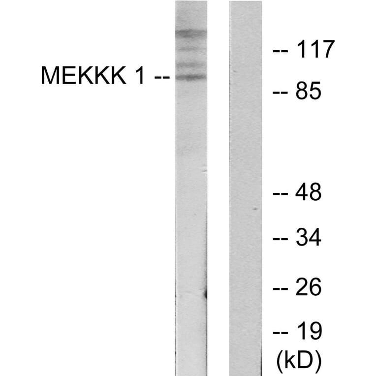 Western Blot - Anti-MEKKK 1 Antibody (C11444) - Antibodies.com