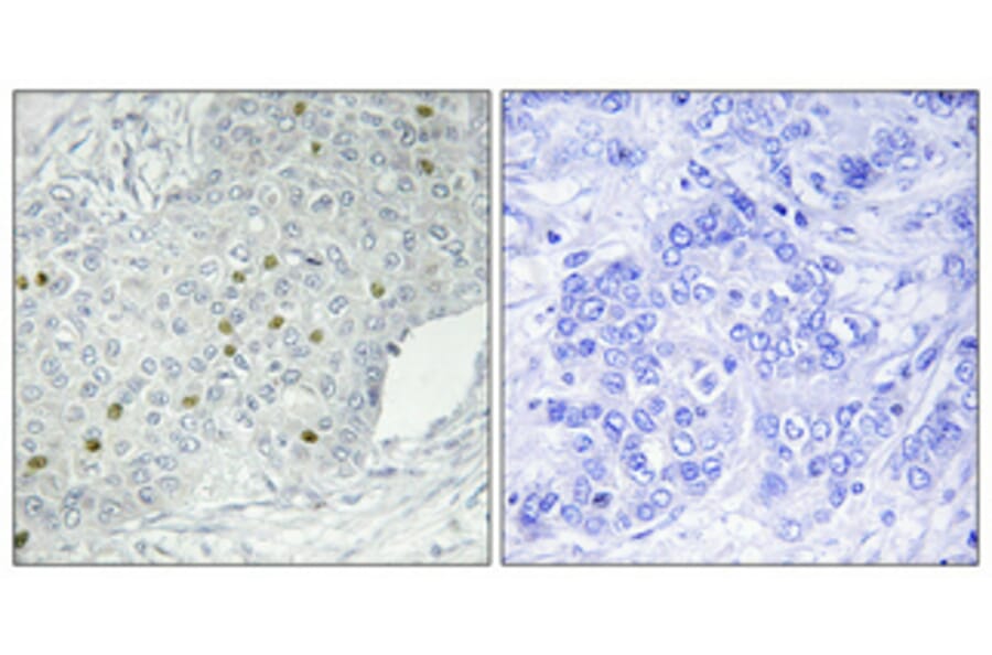 Immunohistochemistry - Anti-MEKKK 1 Antibody (C11444) - Antibodies.com