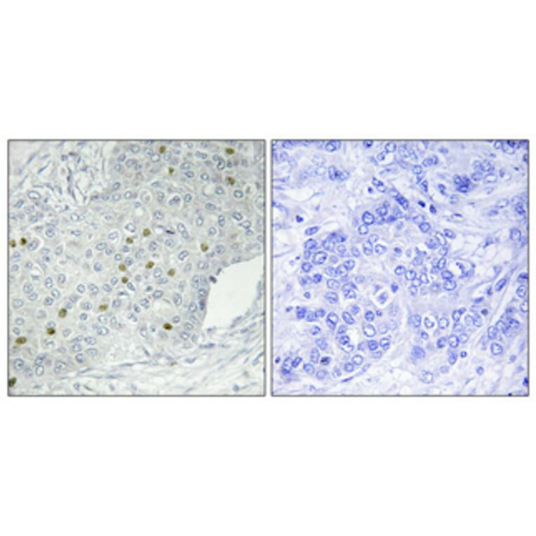 Immunohistochemistry - Anti-MEKKK 1 Antibody (C11444) - Antibodies.com