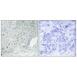 Immunohistochemistry - Anti-MEKKK 1 Antibody (C11444) - Antibodies.com
