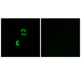 Immunofluorescence - Anti-LDLRAD3 Antibody (C16505) - Antibodies.com