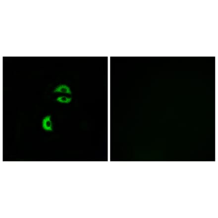 Immunofluorescence - Anti-LDLRAD3 Antibody (C16505) - Antibodies.com