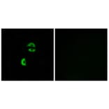 Immunofluorescence - Anti-LDLRAD3 Antibody (C16505) - Antibodies.com