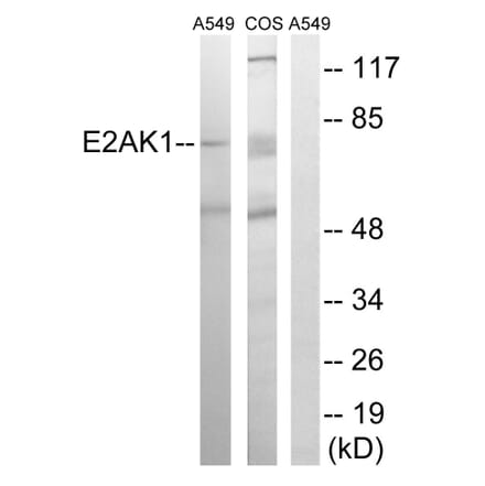 Western Blot - Anti-EIF2AK1 Antibody (C15698) - Antibodies.com