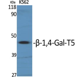 Western Blot - Anti-B4GALT5 Antibody (C14727) - Antibodies.com