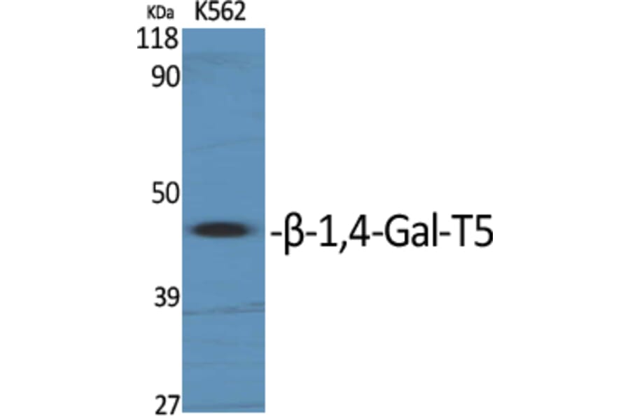 Western Blot - Anti-B4GALT5 Antibody (C14727) - Antibodies.com