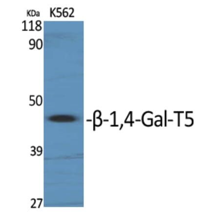 Western Blot - Anti-B4GALT5 Antibody (C14727) - Antibodies.com