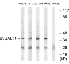 Western Blot - Anti-B3GALT1 Antibody (C14712) - Antibodies.com