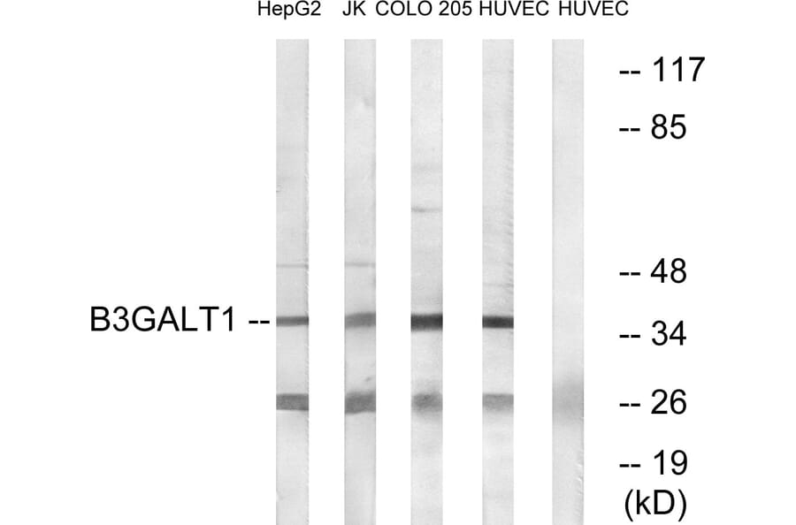 Western Blot - Anti-B3GALT1 Antibody (C14712) - Antibodies.com