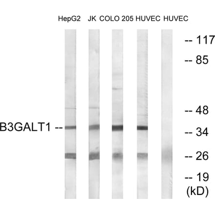 Western Blot - Anti-B3GALT1 Antibody (C14712) - Antibodies.com
