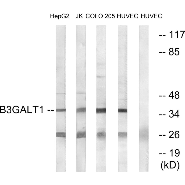 Western Blot - Anti-B3GALT1 Antibody (C14712) - Antibodies.com