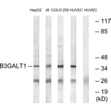 Western Blot - Anti-B3GALT1 Antibody (C14712) - Antibodies.com