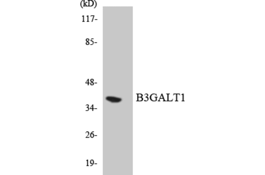 Western Blot - Anti-B3GALT1 Antibody (R12-2529) - Antibodies.com