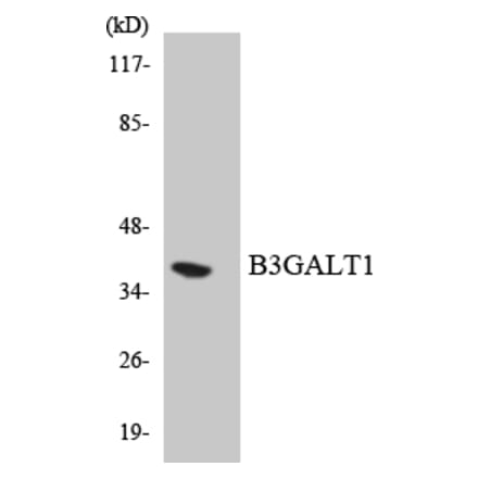 Western Blot - Anti-B3GALT1 Antibody (R12-2529) - Antibodies.com
