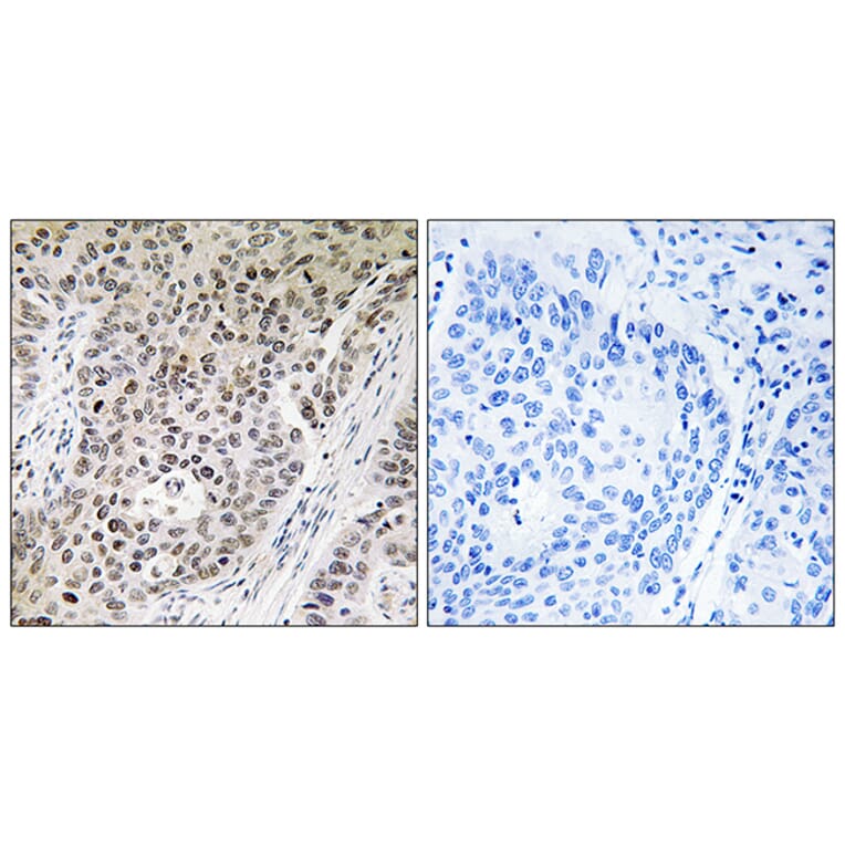 Immunohistochemistry - Anti-ZNF608 Antibody (C19605) - Antibodies.com