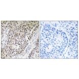 Immunohistochemistry - Anti-ZNF608 Antibody (C19605) - Antibodies.com