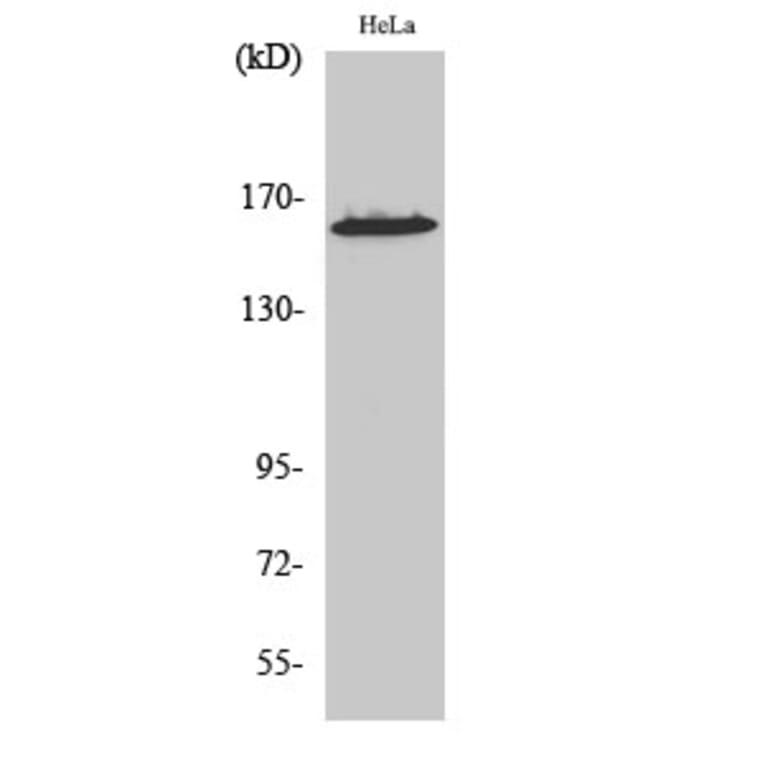 Western Blot - Anti-ZNF608 Antibody (C19605) - Antibodies.com