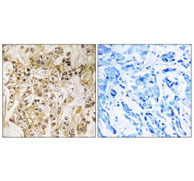 Immunohistochemistry - Anti-ZNF295 Antibody (C19596) - Antibodies.com