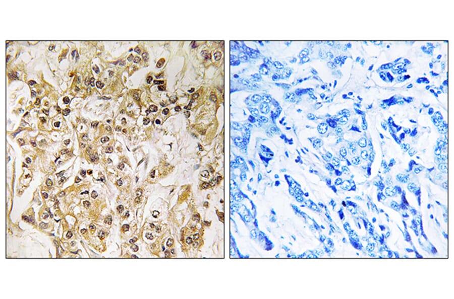 Immunohistochemistry - Anti-ZNF295 Antibody (C19596) - Antibodies.com