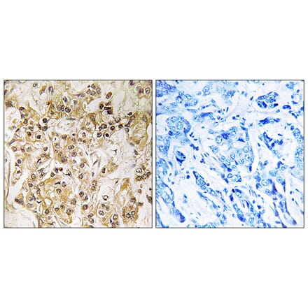 Immunohistochemistry - Anti-ZNF295 Antibody (C19596) - Antibodies.com