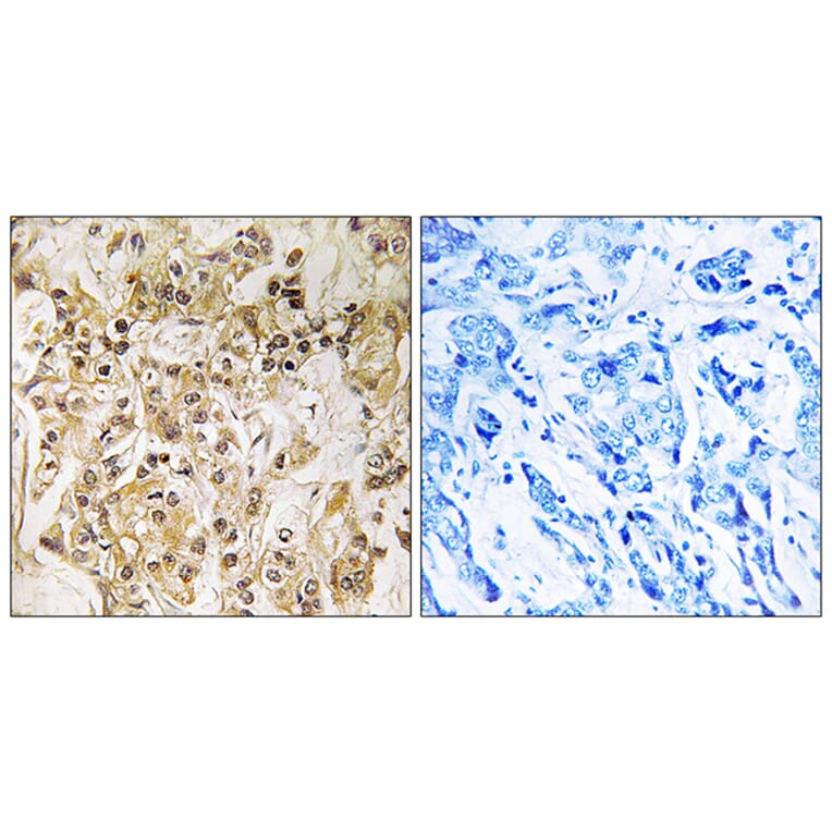 Immunohistochemistry - Anti-ZNF295 Antibody (C19596) - Antibodies.com