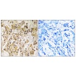 Immunohistochemistry - Anti-ZNF295 Antibody (C19596) - Antibodies.com