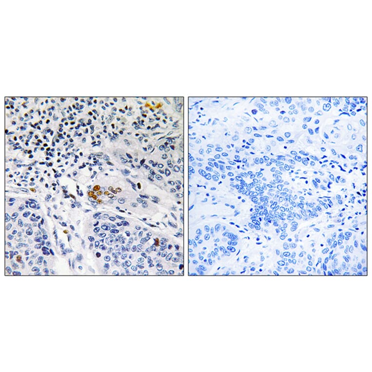 Immunohistochemistry - Anti-ZBTB40 Antibody (C19569) - Antibodies.com