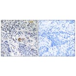 Immunohistochemistry - Anti-ZBTB40 Antibody (C19569) - Antibodies.com