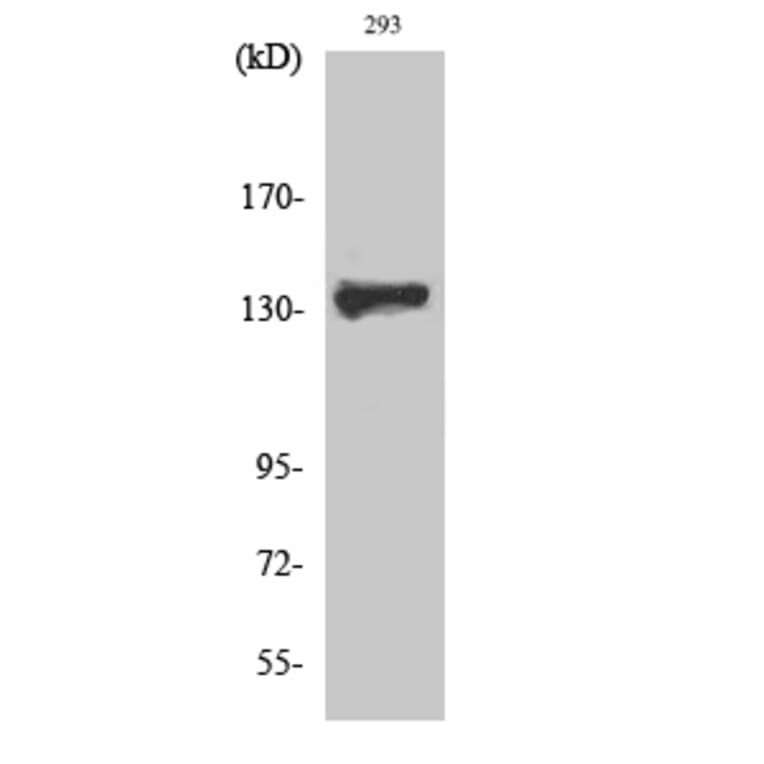 Western Blot - Anti-ZBTB40 Antibody (C19569) - Antibodies.com