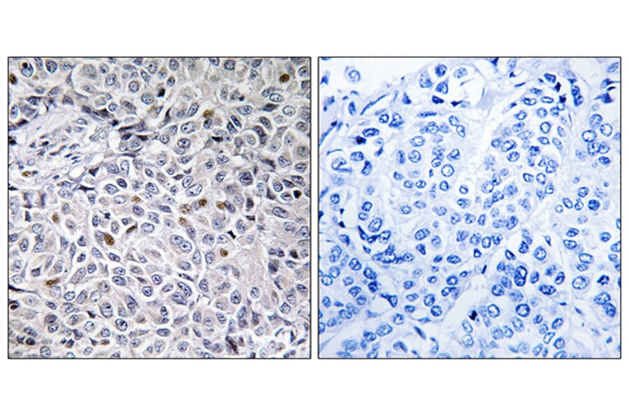 Immunohistochemistry - Anti-ZAP-70 Antibody (B0601) - Antibodies.com